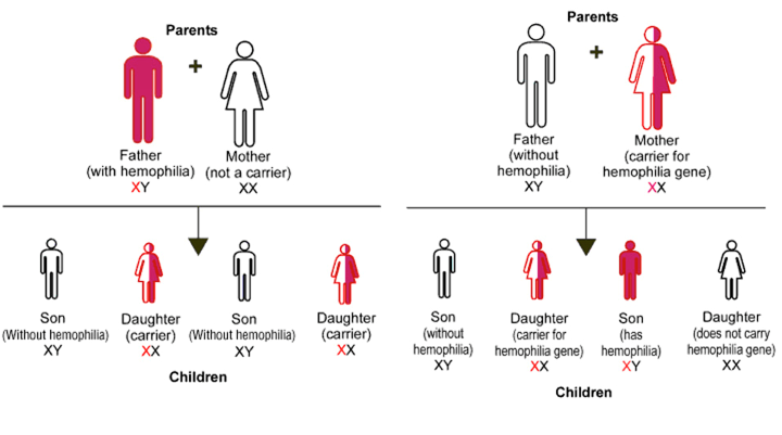 Inheritance of Hemophilia